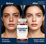 Astaxanthin Softgels High Natural Antioxidant – Skin & Eye Daily Wellness (120 Counts) | OEM Private Label