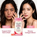 Hair Skin and Nails Collagen Gummies – Women Beauty Dietary Supplement (OEM/ODM Private Label)